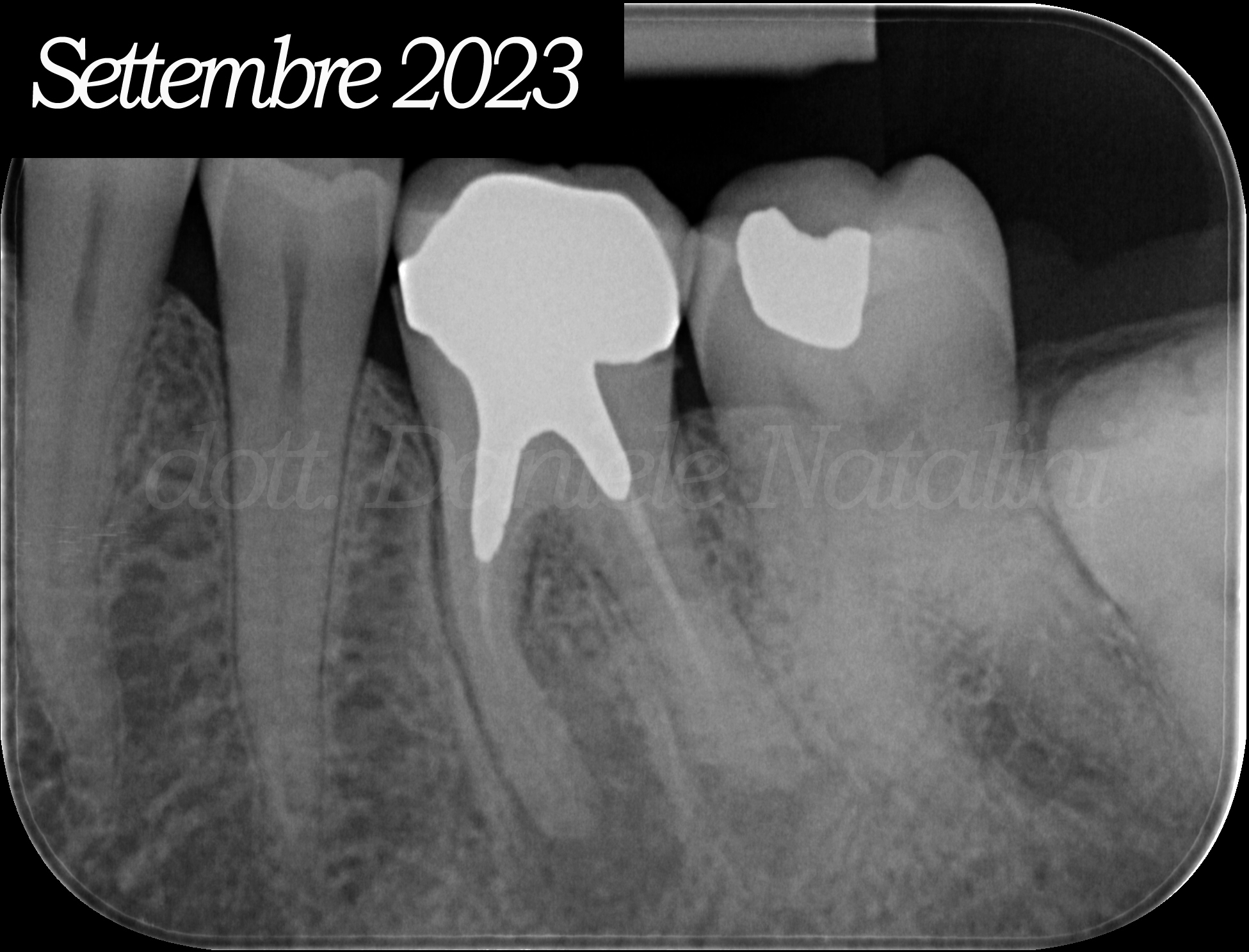 0 - Situazione ex ante elemento 3.6 pre e post ritrattamento