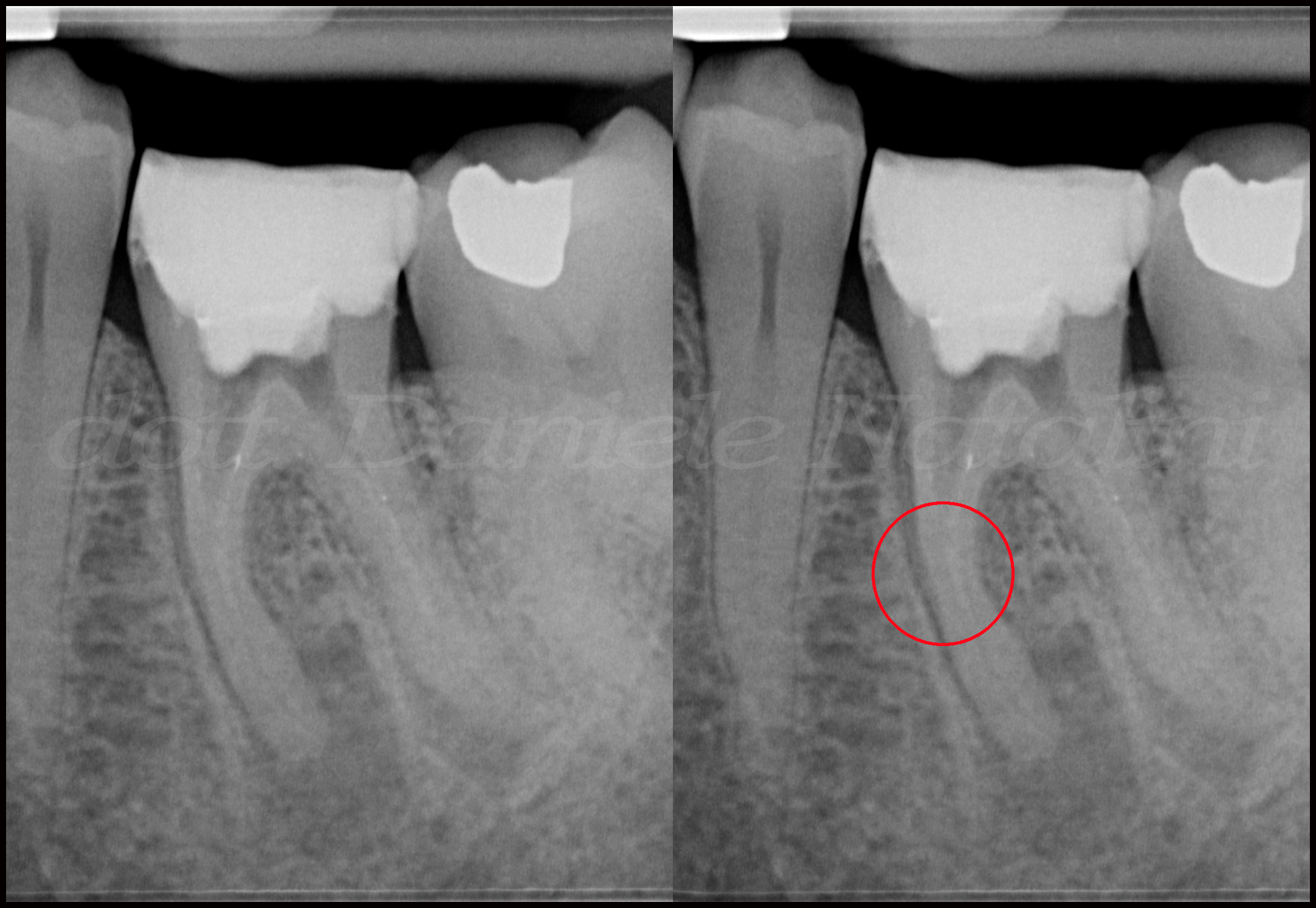 1 - Situazione ex ante elemento 3.6