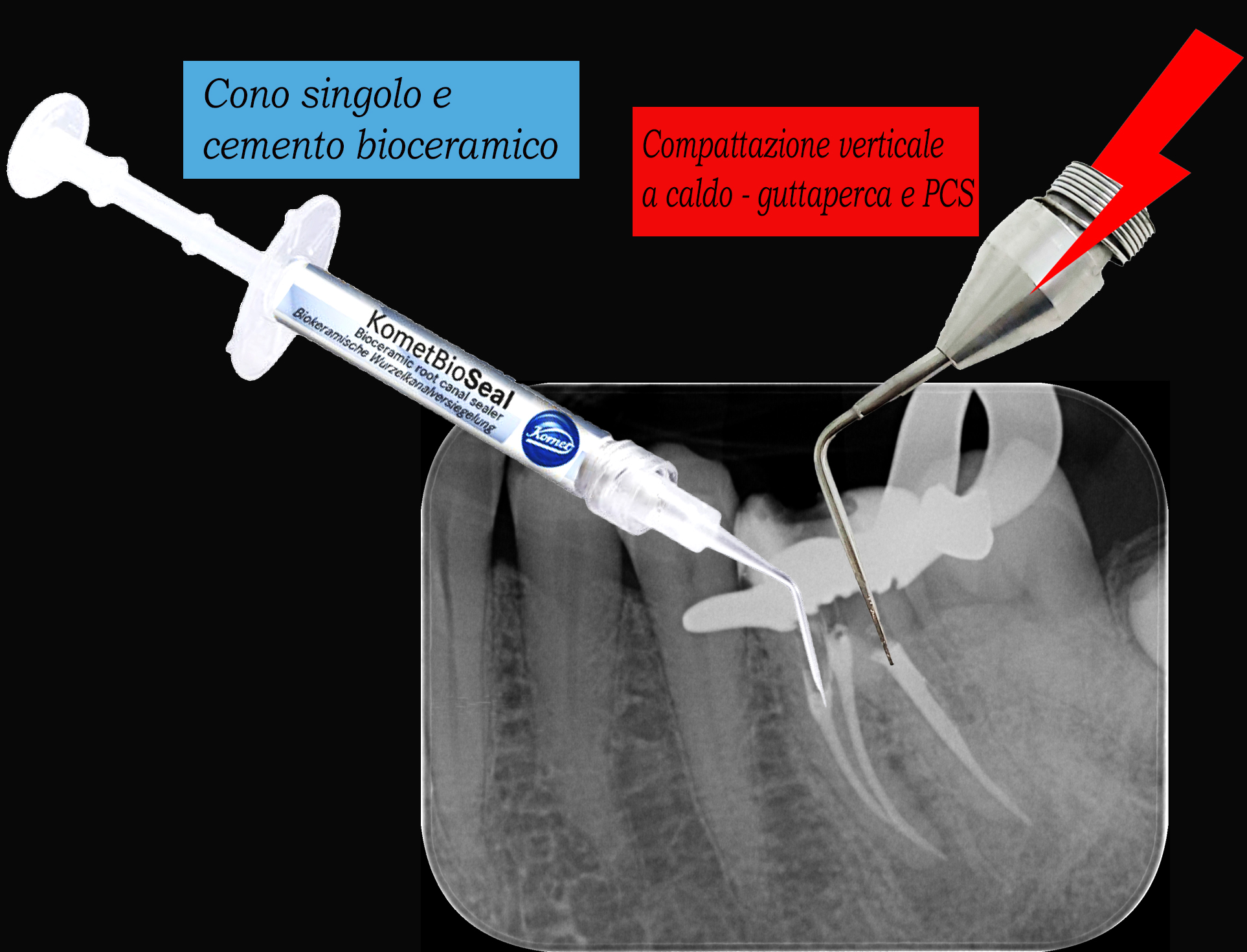 3 - BioSeal e chiusura verticale a caldo